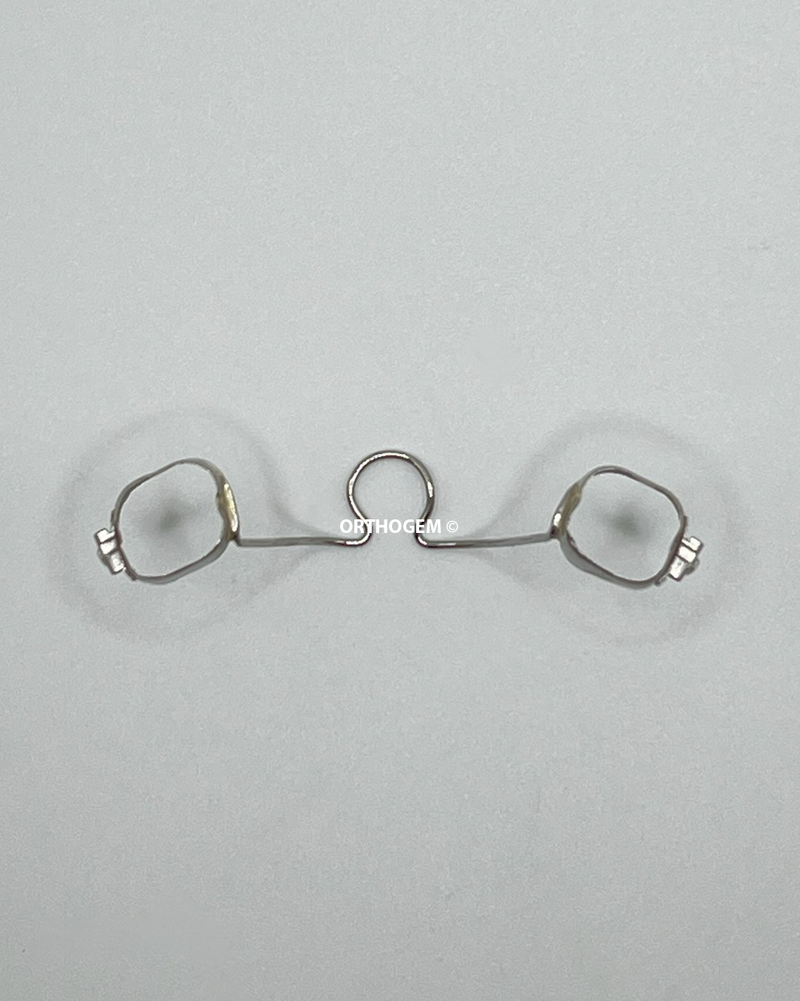 Arc Transpalatin par Orthogem laboratoire spécialisé en prothèse ODF et orthodontie en France qualité réglage rapidité