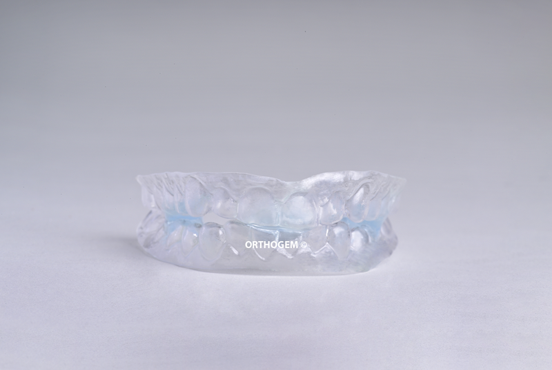 Damon Splint par Orthogem laboratoire spécialisé en prothèse ODF et orthodontie en France qualité réglage rapidité