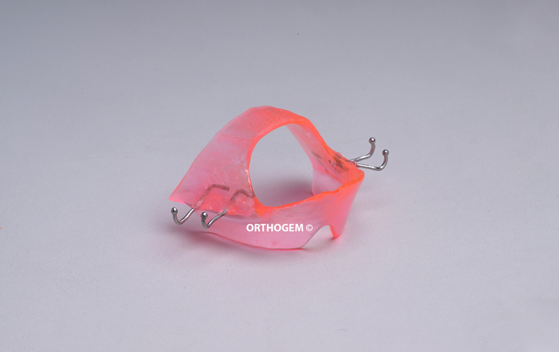 ELN de Bonnet par Orthogem laboratoire spécialisé en prothèse ODF et orthodontie en France qualité réglage rapidité