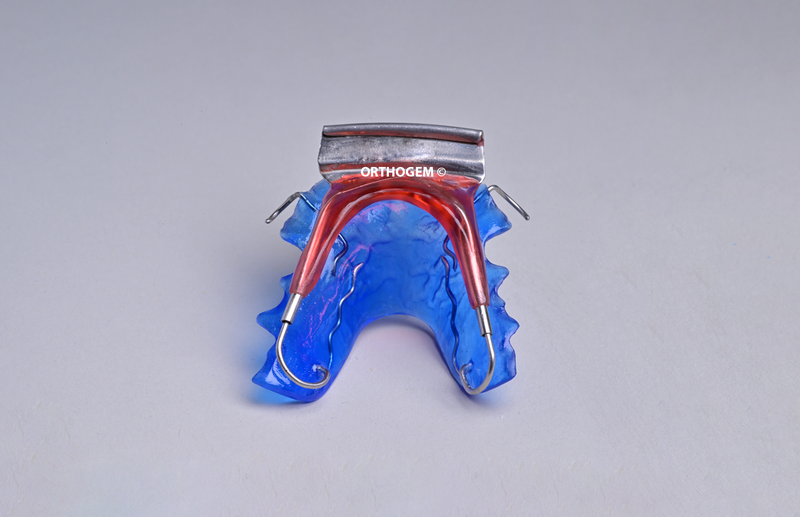 Equiplan de Planas par Orthogem laboratoire spécialisé en prothèse ODF et orthodontie en France qualité réglage rapidité