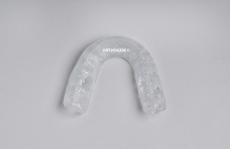 Gouttière de bruxisme réalisée par un laboratoire spécialisé en prothèse ODF et orthodontie occlusion qualité France