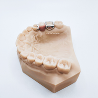 Mainteneur d'espace avec bague anatomique et dent prothétique