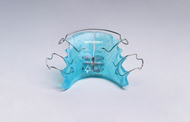 Plaque de Hawley Plaque papillon fabriquée par Orthogem laboratoire de prothèses ODF et orthodontiques France qualité rapidité expertise