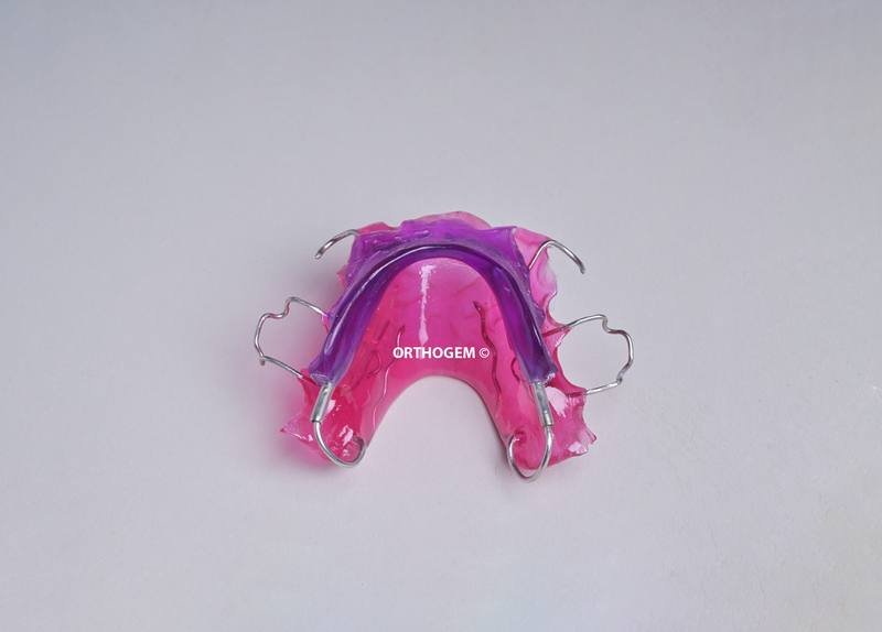 Piste de Planas par Orthogem laboratoire spécialisé en prothèse ODF et orthodontie en France qualité réglage rapidité