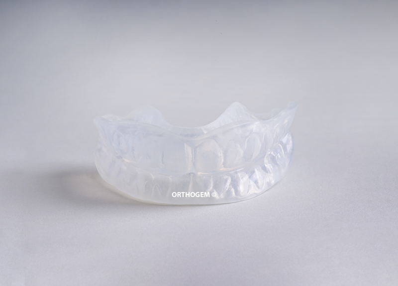 Toothpositioner par Orthogem laboratoire spécialisé en prothèse ODF et orthodontie en France qualité réglage rapidité